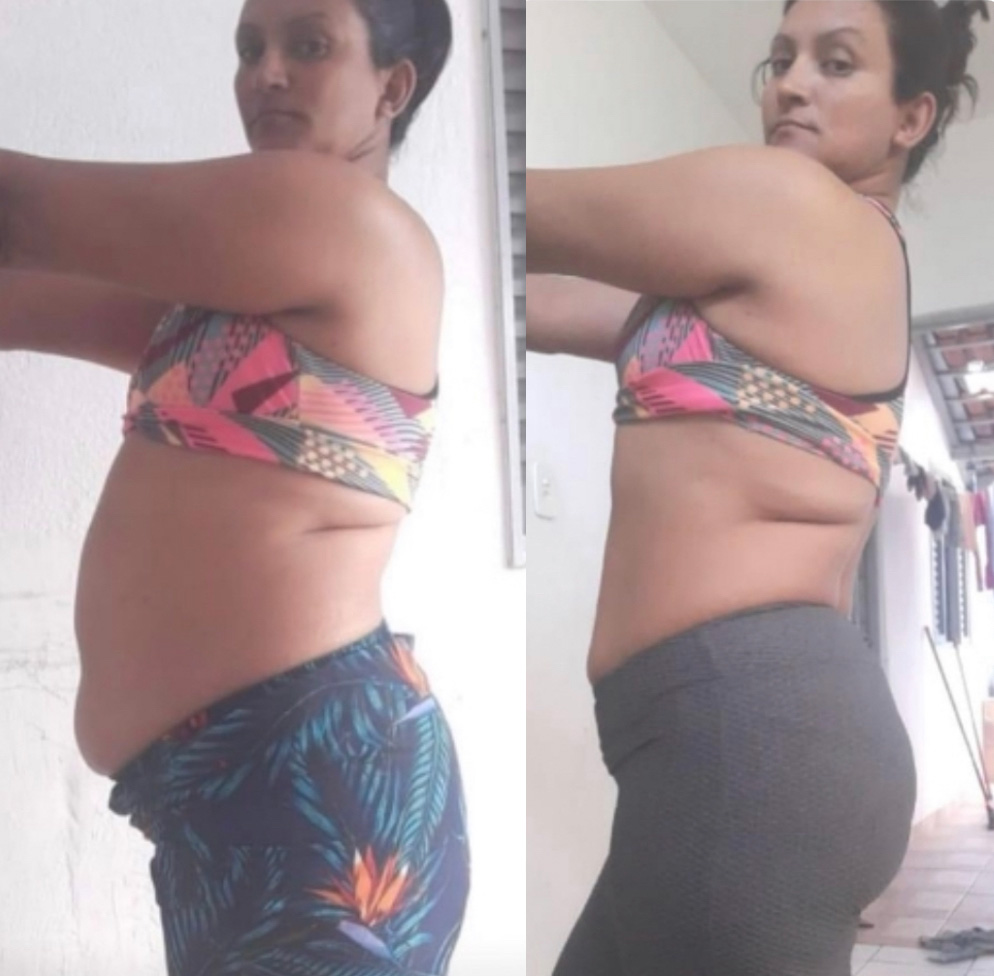 Flaviane, 51 anos — antes e depois com o LIPO10X