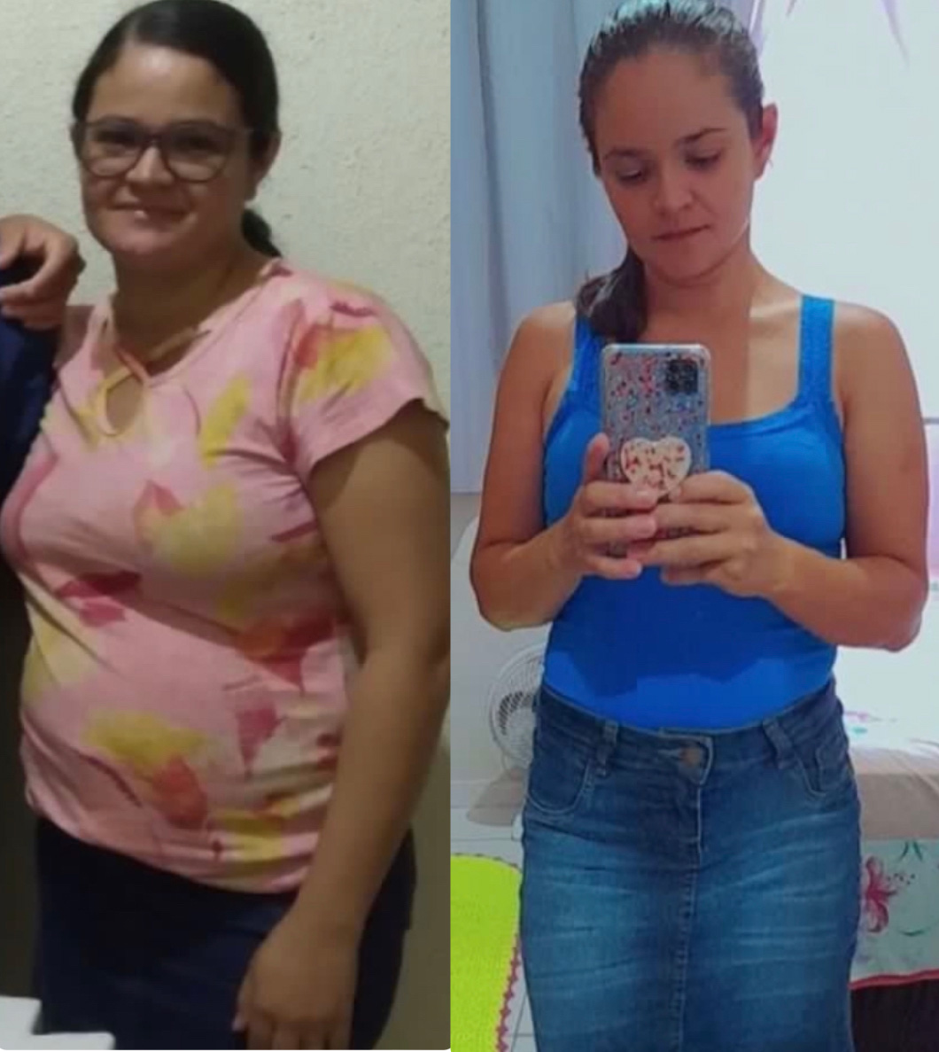 Erika, 37 anos — antes e depois com o LIPO10X