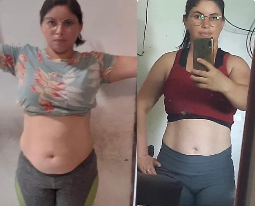Maria Divoneide, 38 anos — antes e depois com o LIPO10X