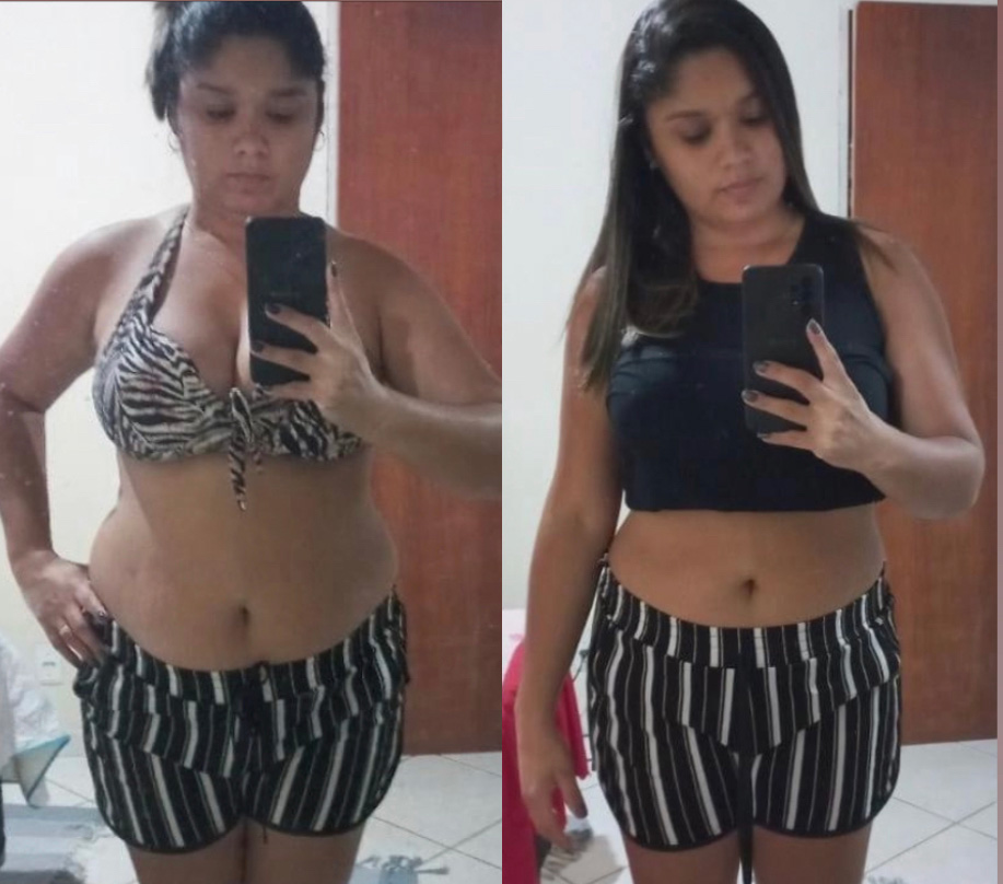 Michele, 34 anos — antes e depois com o LIPO10X