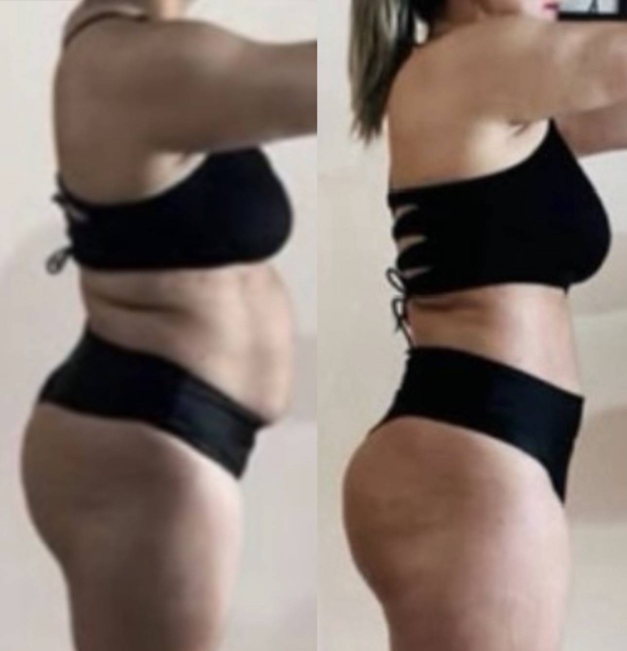 Geane, 37 anos — antes e depois com o LIPO10X